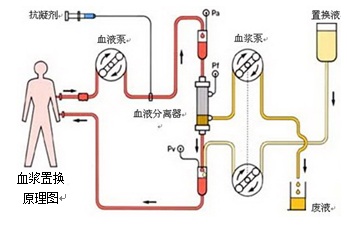 神奇的"换血疗法"-天津市肿瘤医院-北方网企业建站